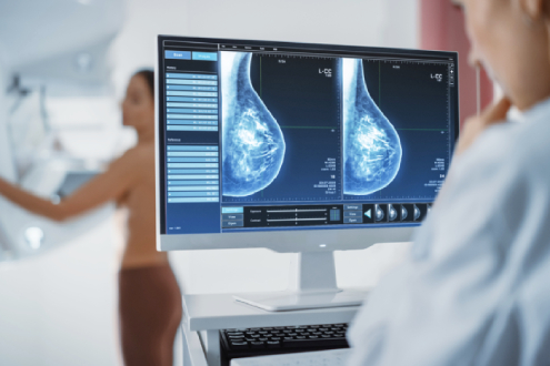 Jul - mesec mamografije